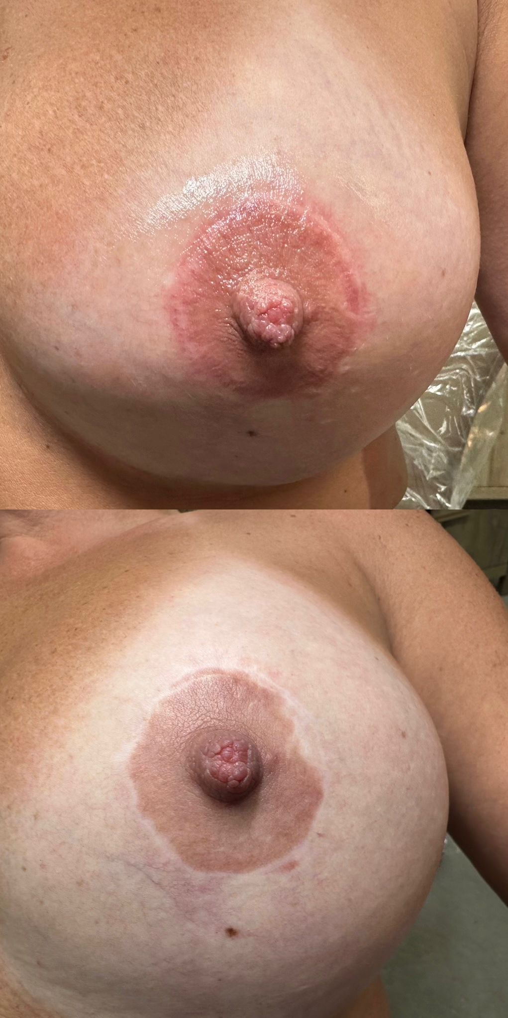 3D areola masterclass — Healing Skin Medical Aesthetics