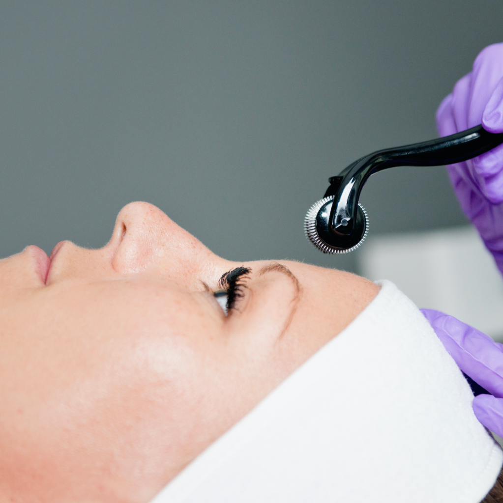 Professional collagen induction therapy Orlando treatment at Healing Skin Medical Aesthetics