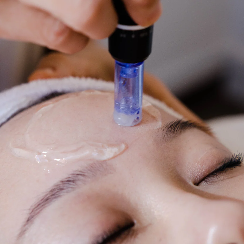 Collagen Induction Therapy Orlando at Healing Skin Medical Aesthetics by Dr. Cecilia Rusnak