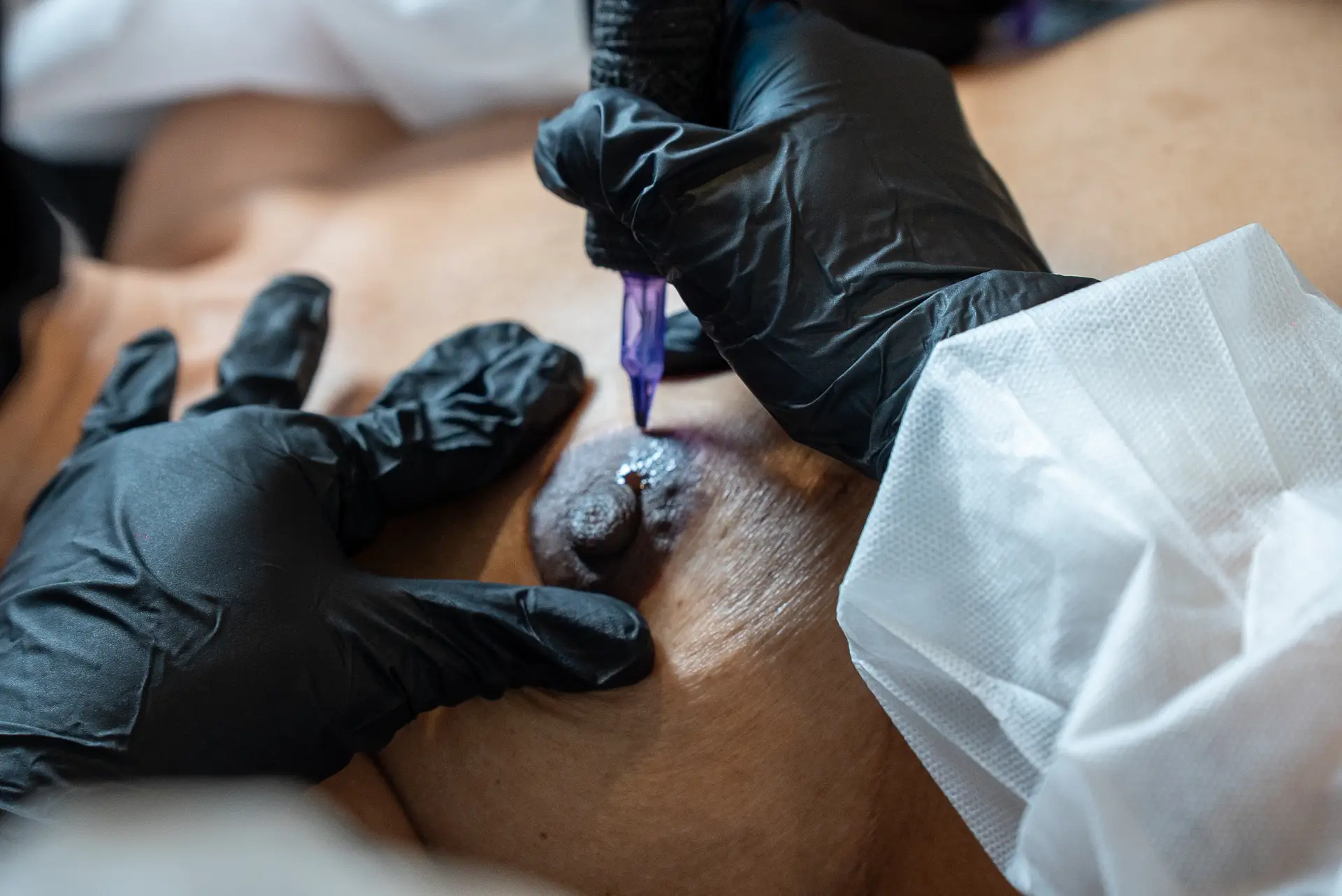 3D areola tattoo Orlando procedure performed by Dr. Cecilia Rusnak at Healing Skin Medical Aesthetics in Kissimmee