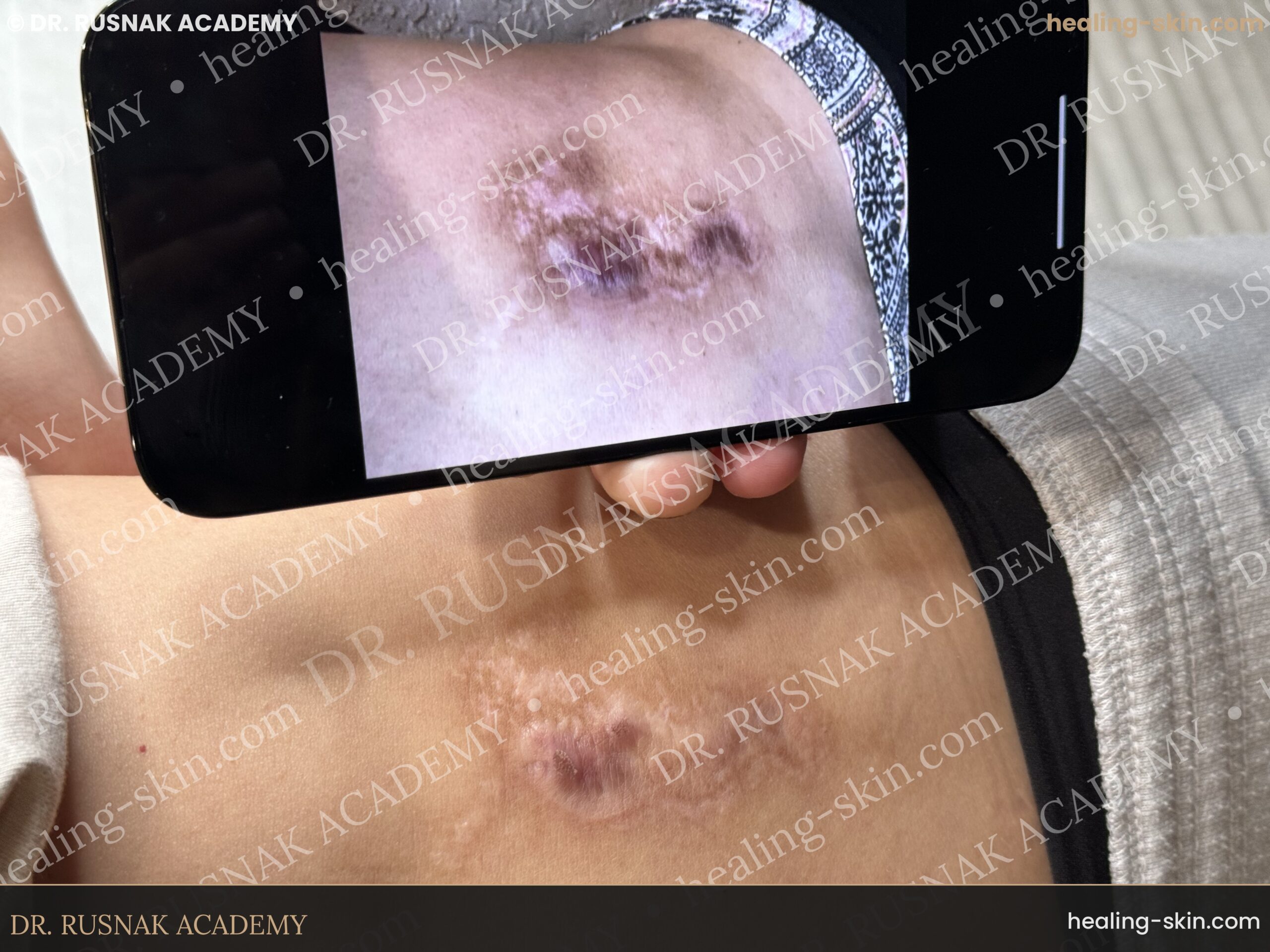 Patient showing before photo and current result