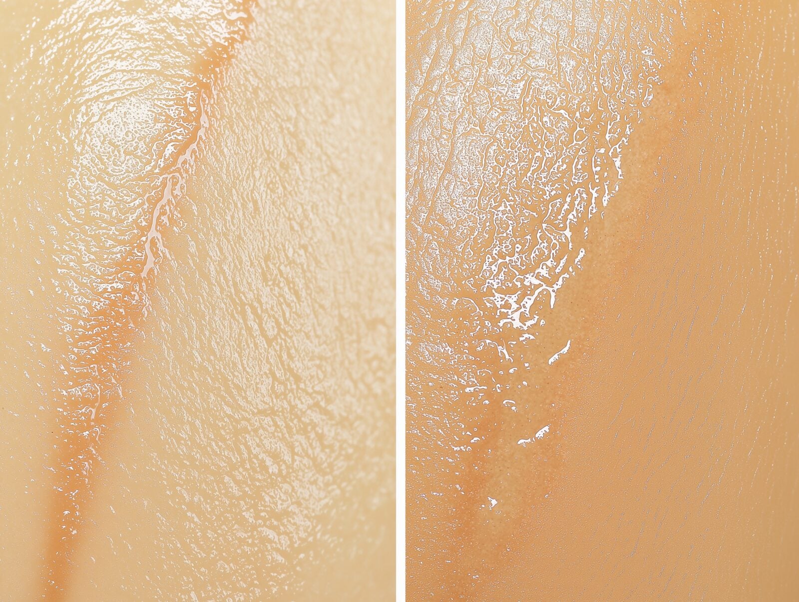 Stretch Mark Camouflage Tattoo Guide: A Complete Walkthrough